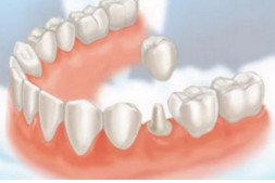 De ce am ales Dental Praxis?